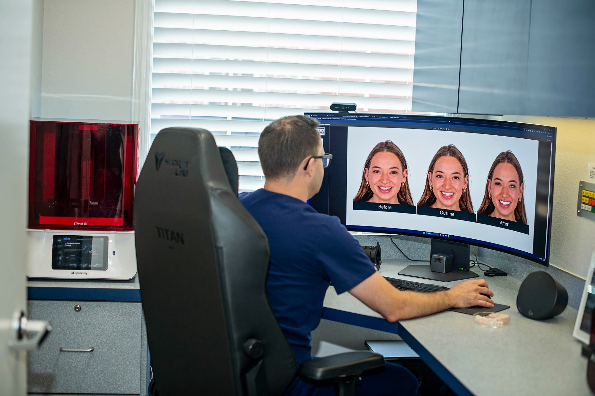 Digital smile design showing before, outline, and after simulation of full-mouth reconstruction outcome